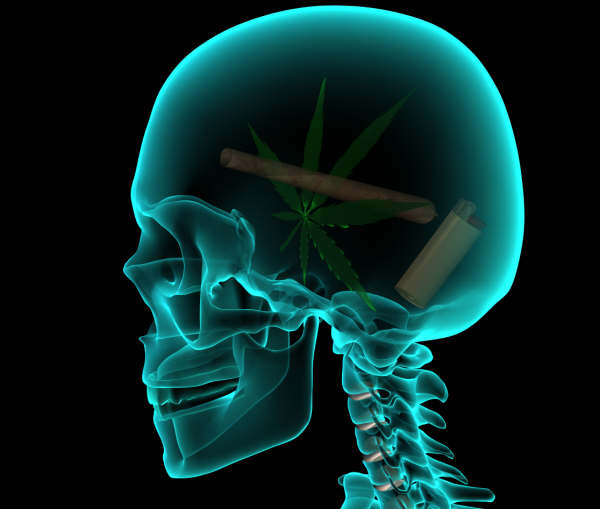 Weed-Brain.jpg